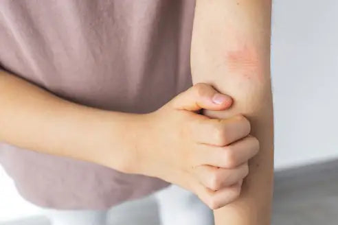 When You Have More Than One Type of Eczema (It's More Common Than You Think)