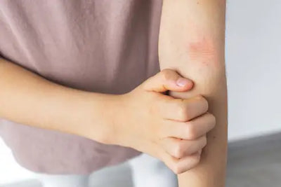 When You Have More Than One Type of Eczema (It's More Common Than You Think)