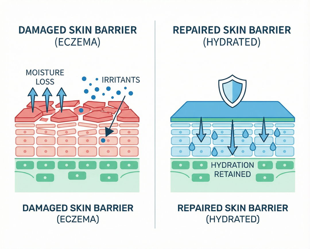 Diagram showing a damaged skin barrier with eczema and a repaired skin barrier with hydration, on a white background.