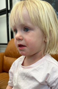 Eczema treatment that works